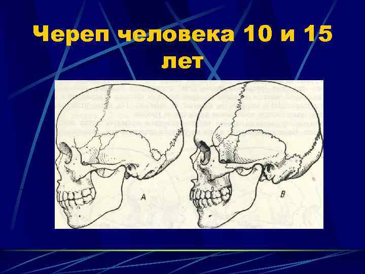 Череп человека 10 и 15 лет 