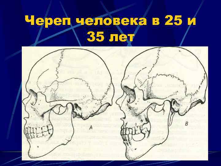 Череп человека в 25 и 35 лет 