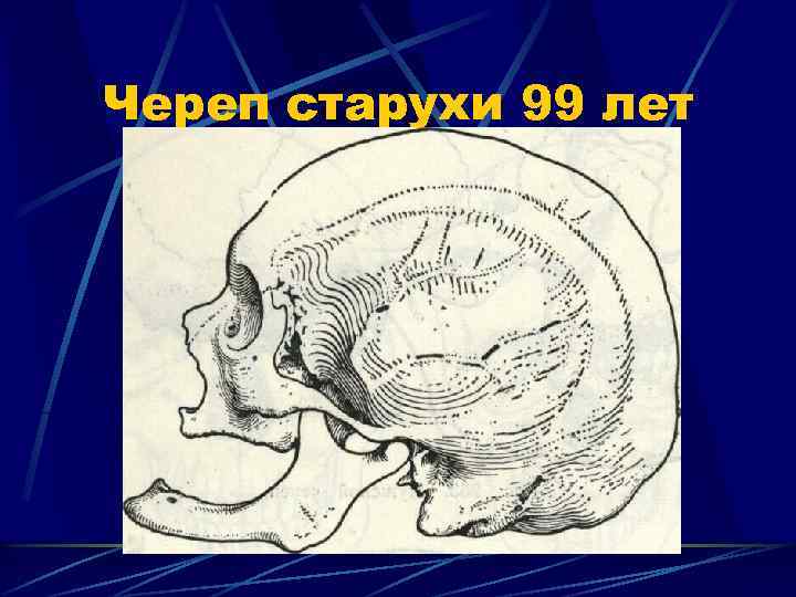 Череп старухи 99 лет 