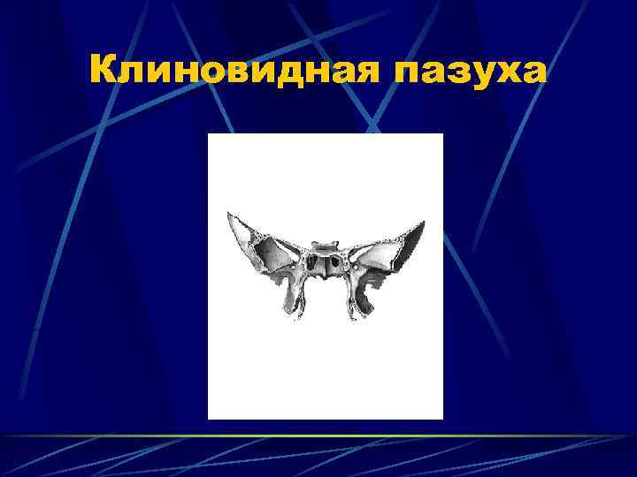 Клиновидная пазуха 