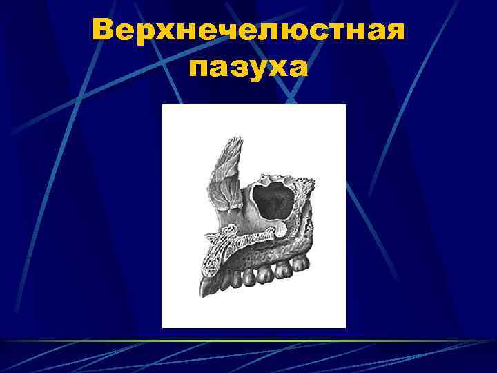 Верхнечелюстная пазуха 