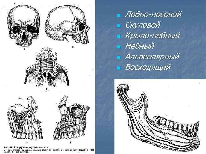 n n n Лобно-носовой Скуловой Крыло-небный Небный Альвеолярный Восходящий 