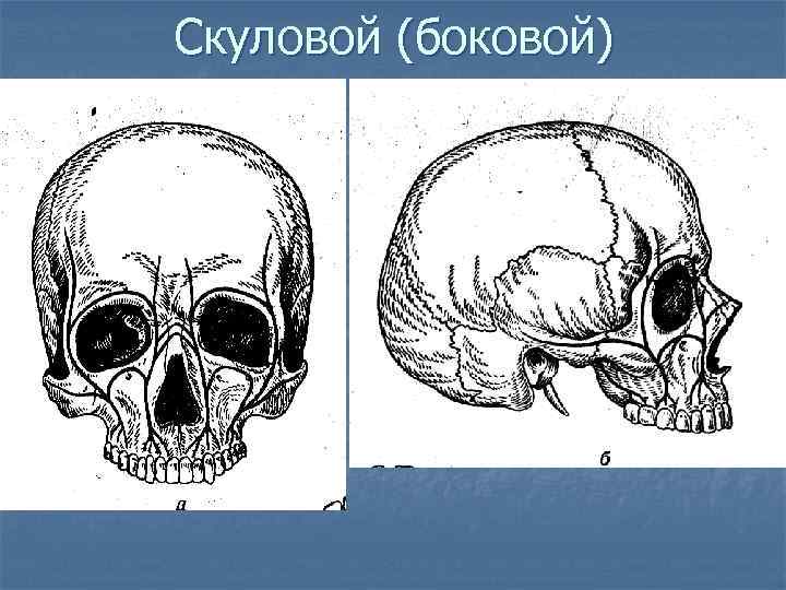 Скуловой (боковой) 