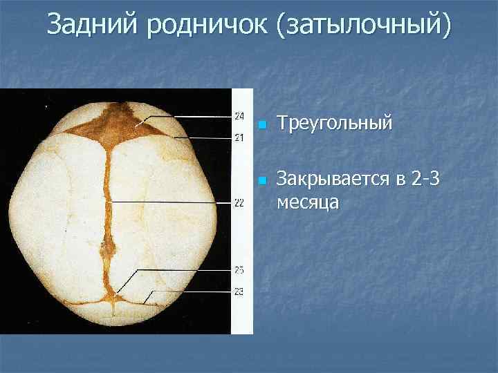 Задний родничок (затылочный) n n Треугольный Закрывается в 2 -3 месяца 