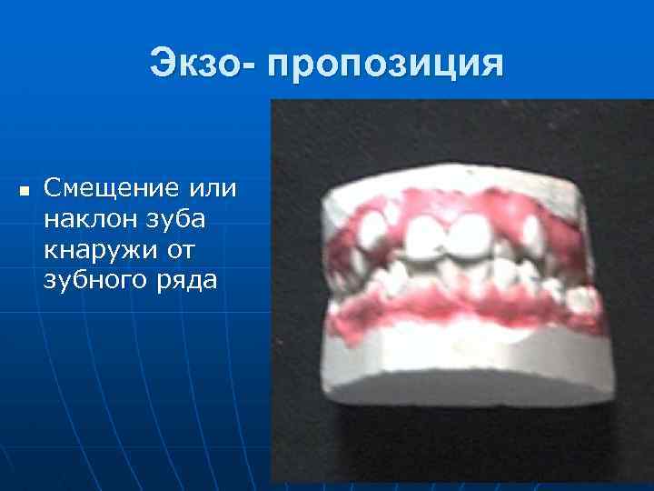 Реакция на прорезывание зубов карта вызова скорой медицинской