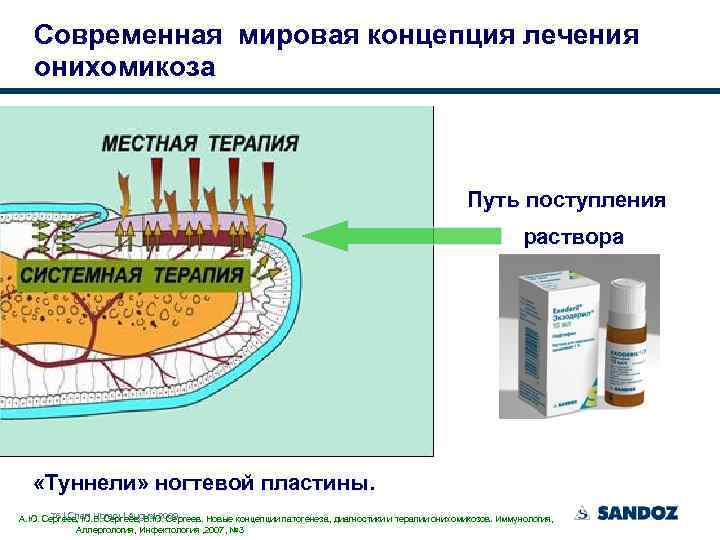 Современная мировая концепция лечения онихомикоза Путь поступления раствора «Туннели» ногтевой пластины. 76 | Chart