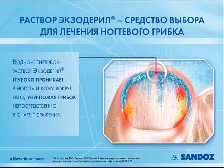 Раствор Экзодерил –средство выбора для лечения онихомикоза § 81 | Chart Library | August