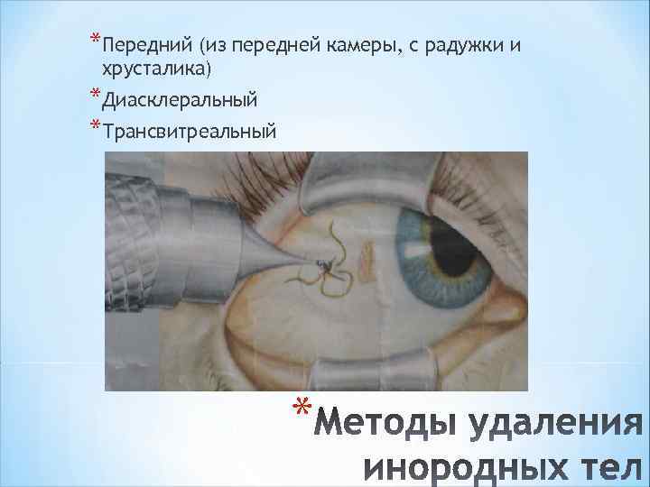 *Передний (из передней камеры, с радужки и хрусталика) *Диасклеральный *Трансвитреальный * 