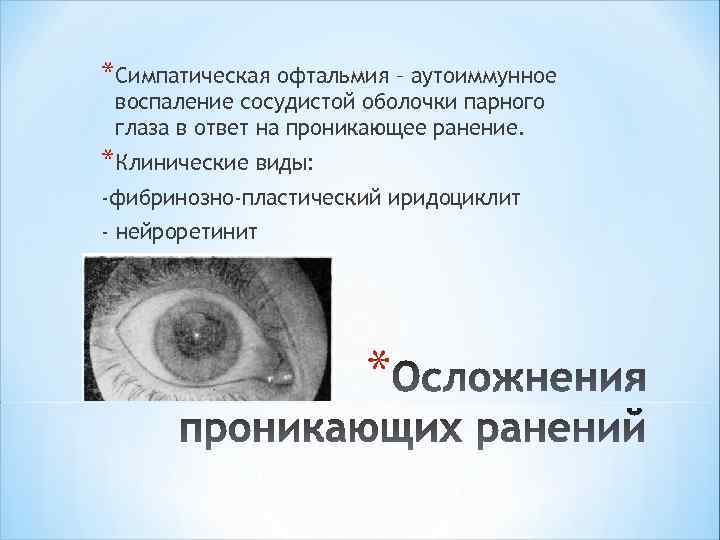 *Симпатическая офтальмия – аутоиммунное воспаление сосудистой оболочки парного глаза в ответ на проникающее ранение.