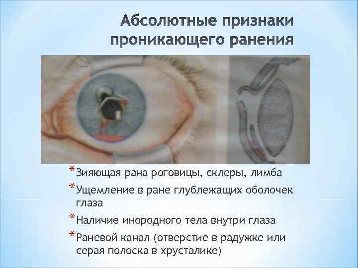 *Зияющая рана роговицы, склеры, лимба *Ущемление в ране глублежащих оболочек глаза *Наличие инородного тела