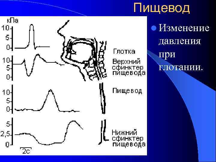 Пищевод l Изменение давления при глотании. 