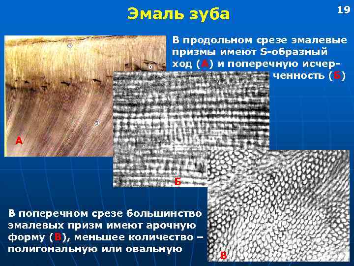 Эмаль зуба 19 В продольном срезе эмалевые призмы имеют S-образный ход (А) и поперечную