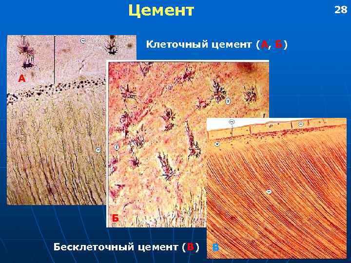 Цемент 28 Клеточный цемент (А, Б) А Б Бесклеточный цемент (В) В 