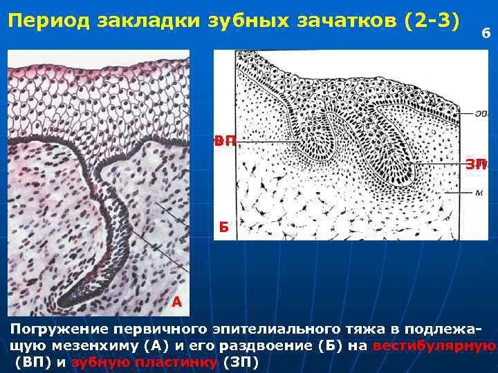 Период закладки зубных зачатков (2 -3) 6 ВП ЗП Б А Погружение первичного эпителиального