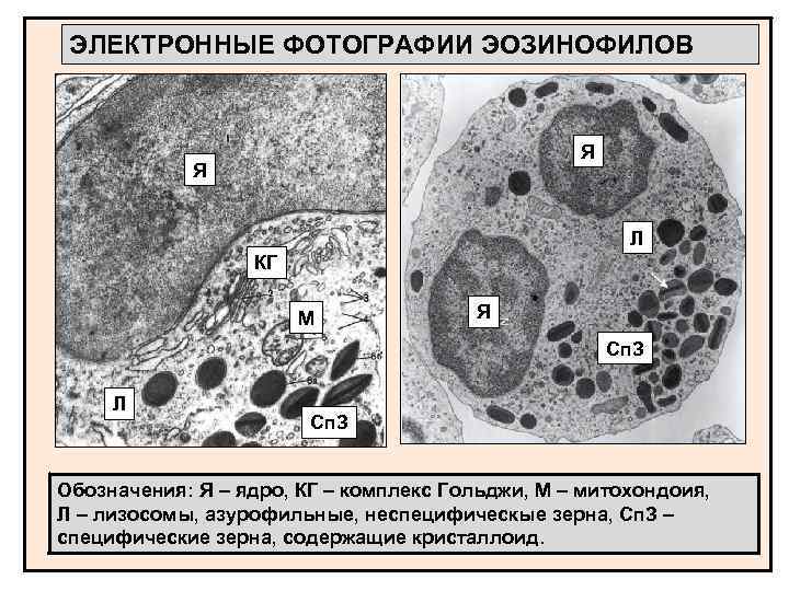 ЭЛЕКТРОННЫЕ ФОТОГРАФИИ ЭОЗИНОФИЛОВ Я Я Л КГ М Я Сп. З Л Сп. З