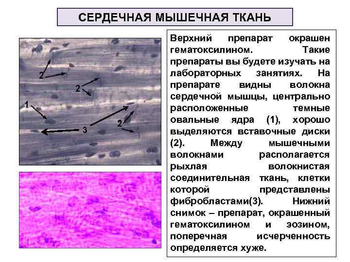 Поперечно полосатая сердечная мышечная ткань гистология рисунок