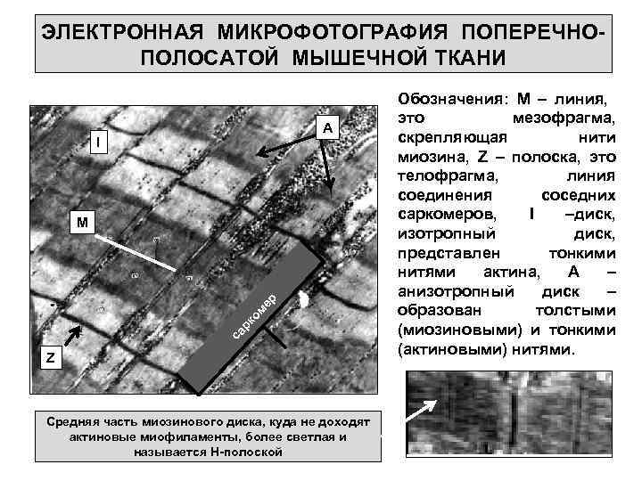 ЭЛЕКТРОННАЯ МИКРОФОТОГРАФИЯ ПОПЕРЕЧНОПОЛОСАТОЙ МЫШЕЧНОЙ ТКАНИ A I са рк ом ер M Z Средняя