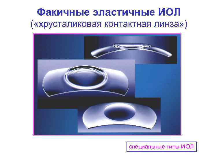 Факичные эластичные ИОЛ ( «хрусталиковая контактная линза» ) специальные типы ИОЛ 