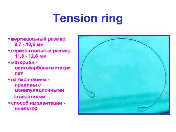Tension ring • вертикальный размер 9, 7 - 10, 6 мм • горизонтальный размер