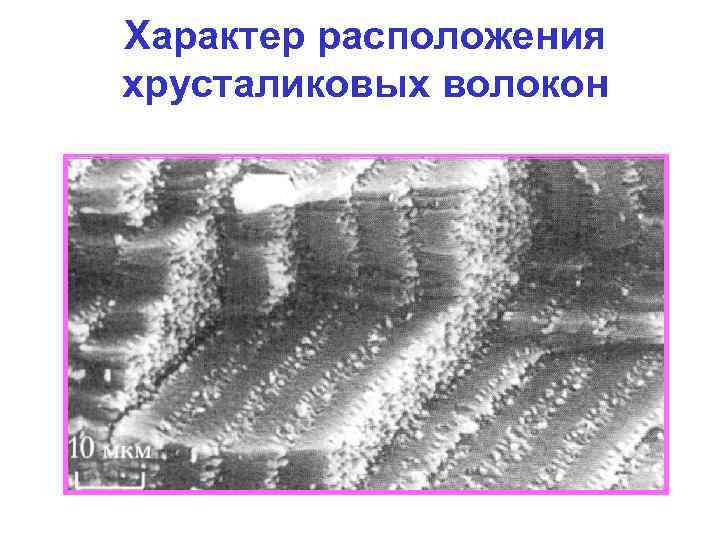 Характер расположения хрусталиковых волокон 