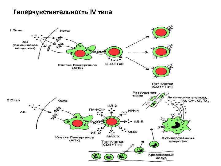 Гиперчувствительность IV типа 