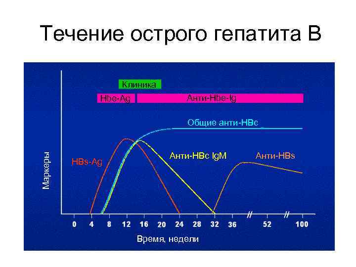 Течение острого гепатита В Клиника Hbe-Ag Анти-Hbe-Ig Маркеры Общие анти-HBc HBs-Ag Анти-HBc Ig. M