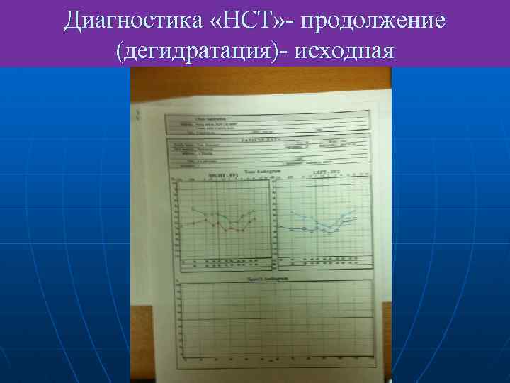 Диагностика «НСТ» - продолжение (дегидратация)- исходная 