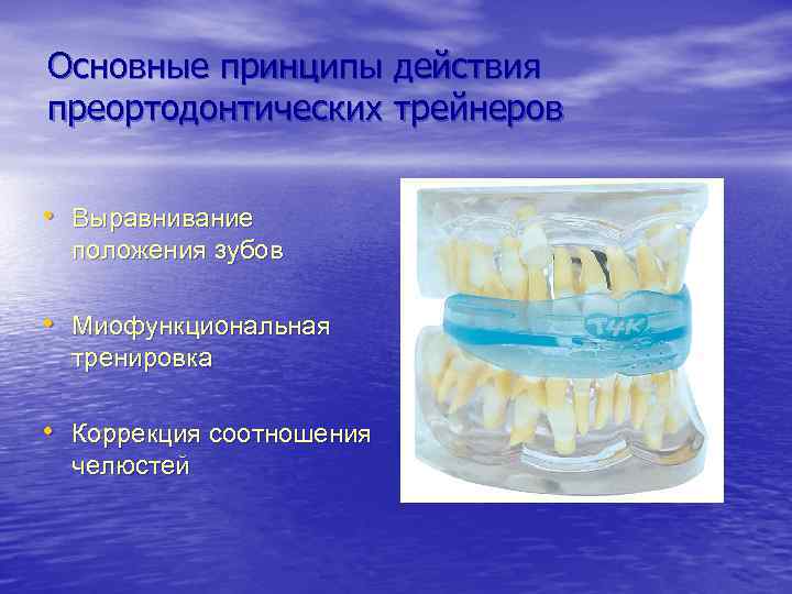 Основные принципы действия преортодонтических трейнеров • Выравнивание положения зубов • Миофункциональная тренировка • Коррекция