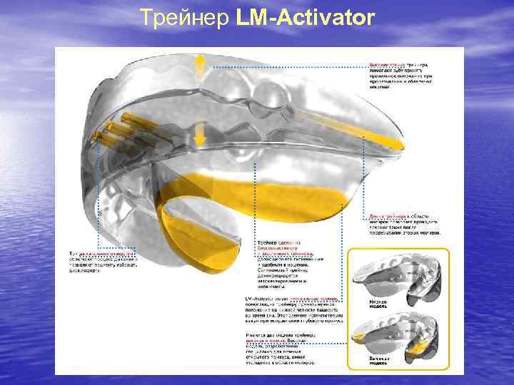 Трейнер LM-Activator 