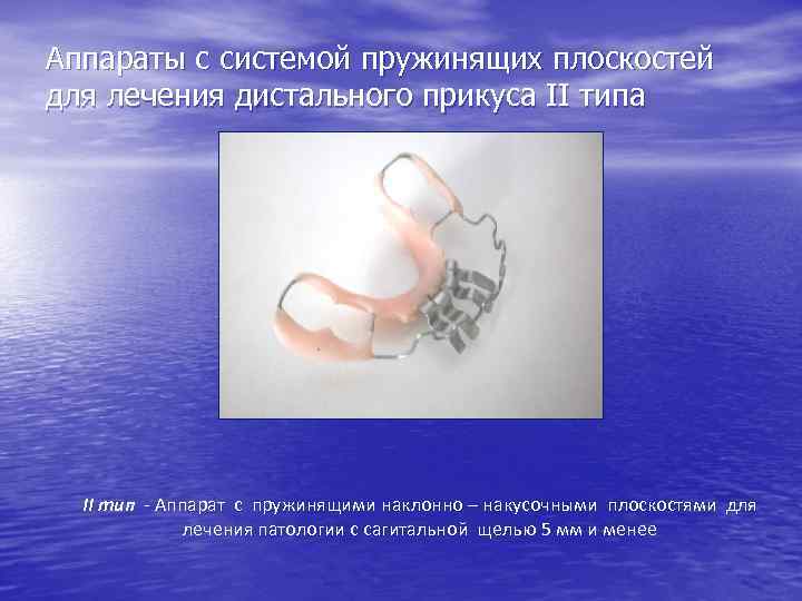 Аппараты с системой пружинящих плоскостей для лечения дистального прикуса II тип - Аппарат с