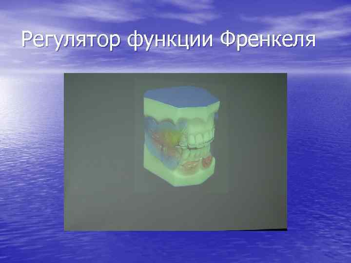 Регулятор функции Френкеля 