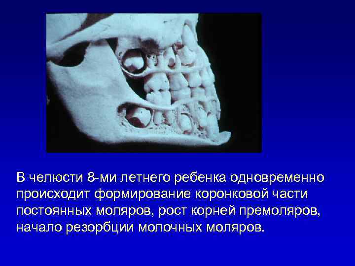 В челюсти 8 -ми летнего ребенка одновременно происходит формирование коронковой части постоянных моляров, рост