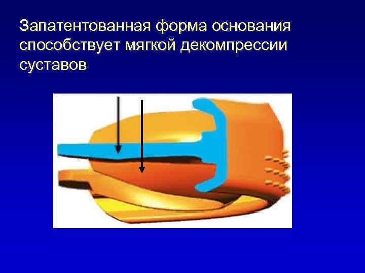 Запатентованная форма основания способствует мягкой декомпрессии суставов 