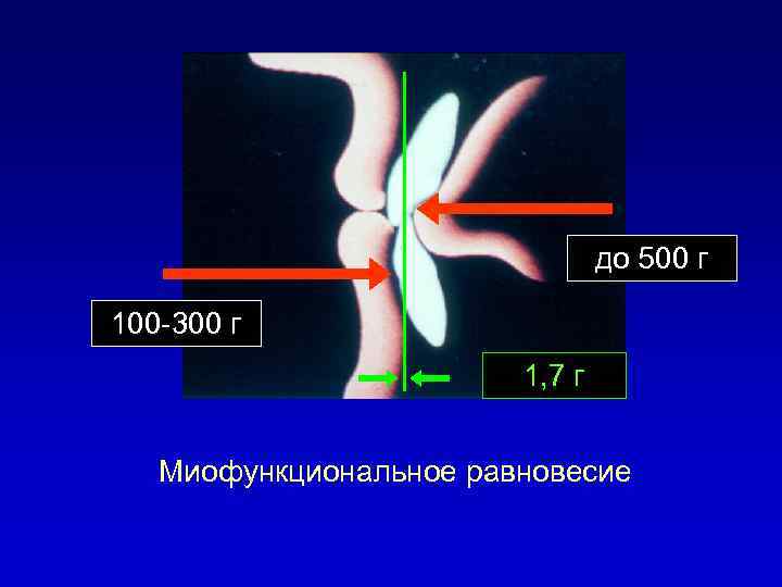 до 500 г 100 -300 г 1, 7 г Миофункциональное равновесие 