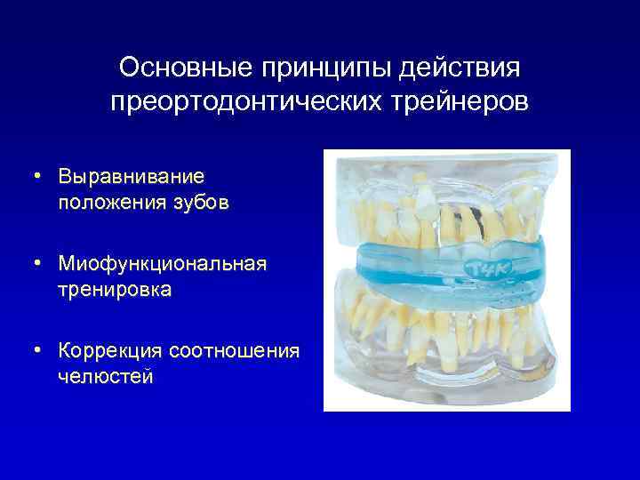 Основные принципы действия преортодонтических трейнеров • Выравнивание положения зубов • Миофункциональная тренировка • Коррекция