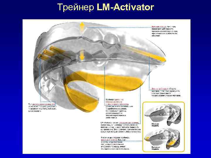 Трейнер LM-Activator 