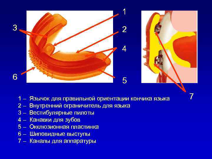 1 3 2 4 6 5 1– 2– 3– 4– 5– 6– 7– Язычок