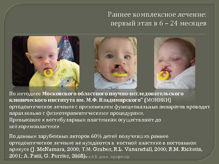 Раннее комплексное лечение: первый этап в 6 – 24 месяцев По методике Московского областного