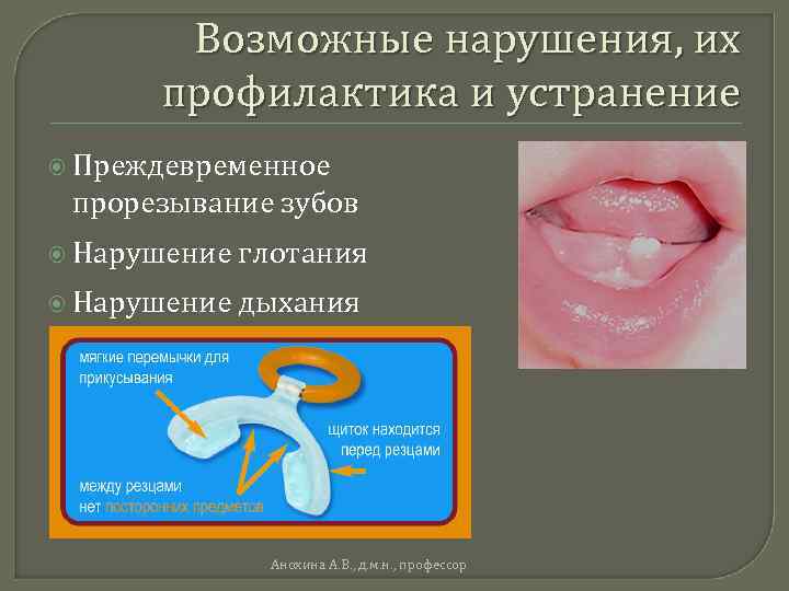 Возможные нарушения, их профилактика и устранение Преждевременное прорезывание зубов Нарушение глотания Нарушение дыхания Анохина