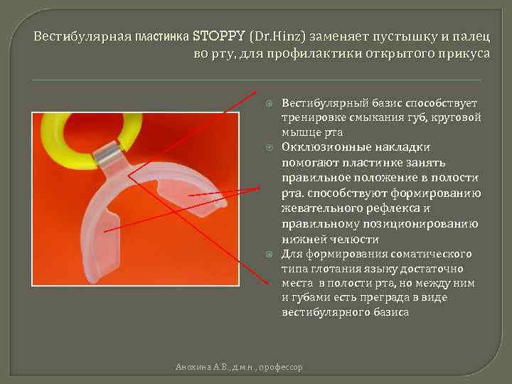 Вестибулярная пластинка STOPPY (Dr. Hinz) заменяет пустышку и палец во рту, для профилактики открытого