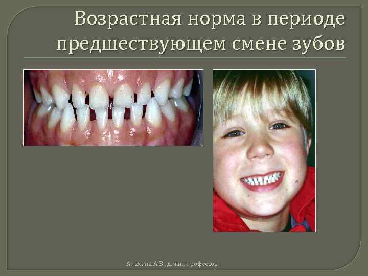 Возрастная норма в периоде предшествующем смене зубов Анохина А. В. , д. м. н.