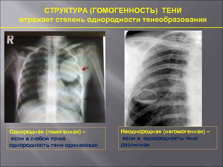 Рентген норма