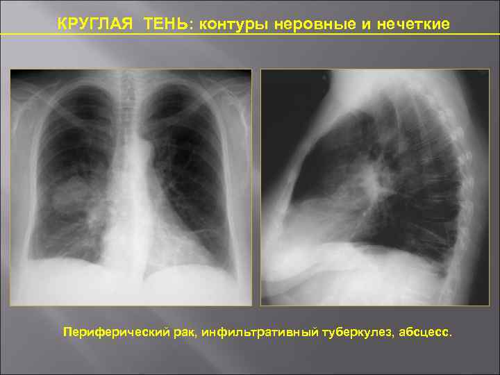 Контуры неровные нечеткие