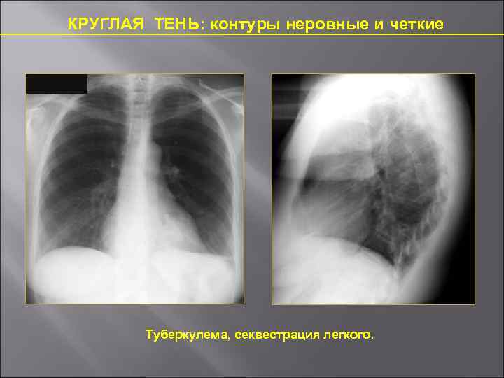 Контуры узла четкие неровные