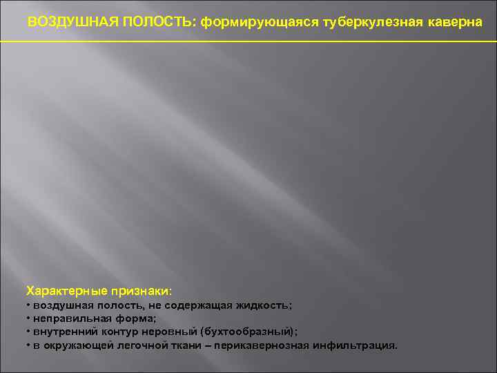 ВОЗДУШНАЯ ПОЛОСТЬ: формирующаяся туберкулезная каверна Характерные признаки: • воздушная полость, не содержащая жидкость; •