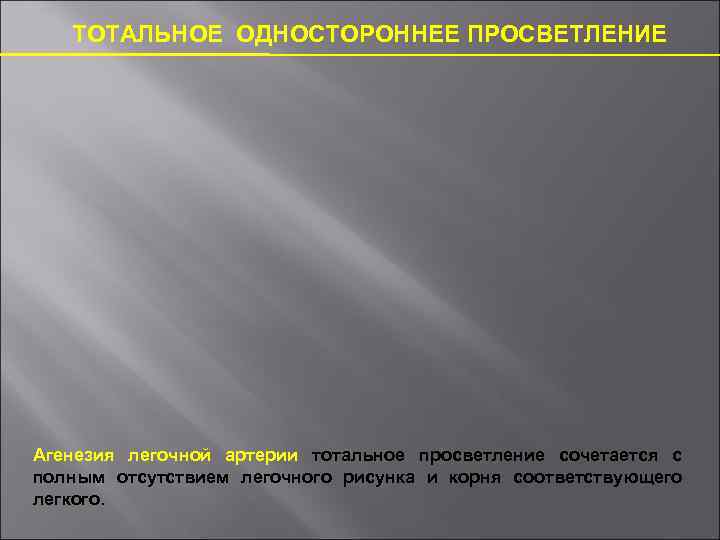 ТОТАЛЬНОЕ ОДНОСТОРОННЕЕ ПРОСВЕТЛЕНИЕ Агенезия легочной артерии тотальное просветление сочетается с полным отсутствием легочного рисунка