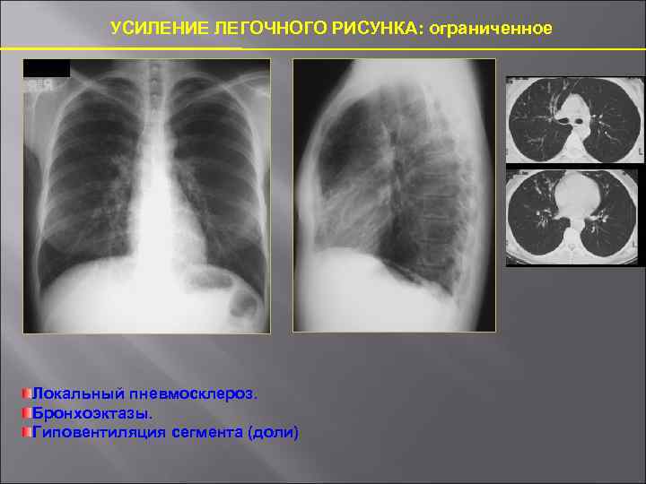 Усиление рисунка в прикорневых зонах