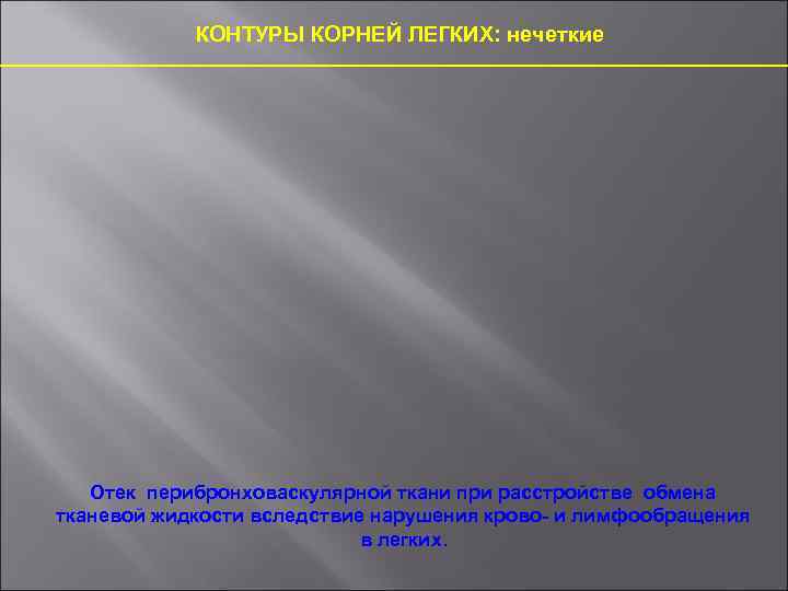 КОНТУРЫ КОРНЕЙ ЛЕГКИХ: нечеткие Отек перибронховаскулярной ткани при расстройстве обмена тканевой жидкости вследствие нарушения