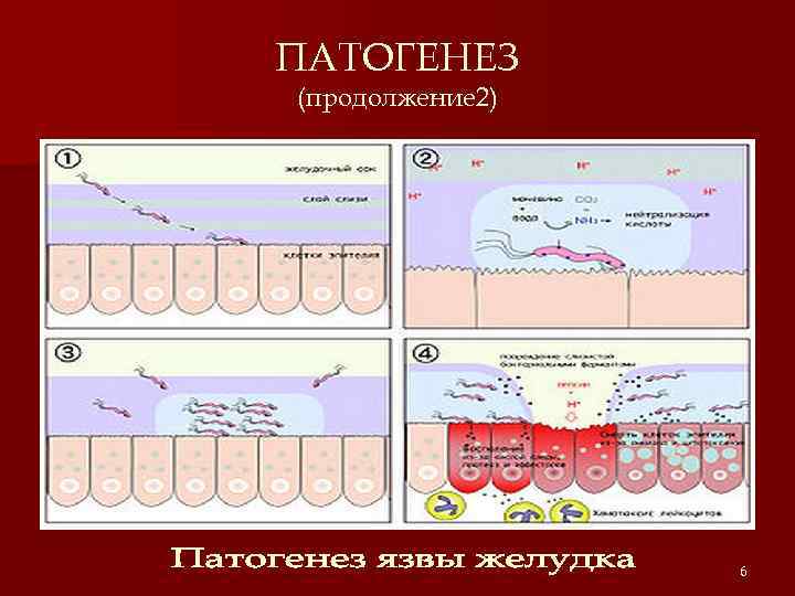 ПАТОГЕНЕЗ (продолжение 2) 6 