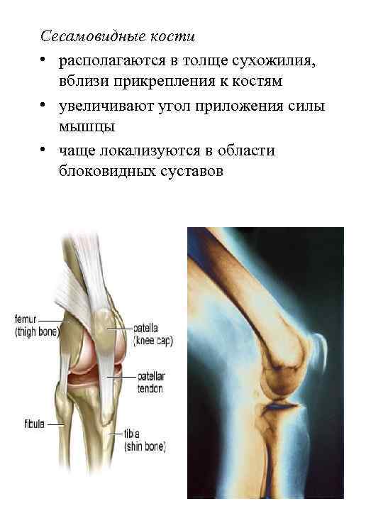 Сесамовидные кости • располагаются в толще сухожилия, вблизи прикрепления к костям • увеличивают угол